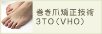 巻き爪矯正技術3TO（VHO）